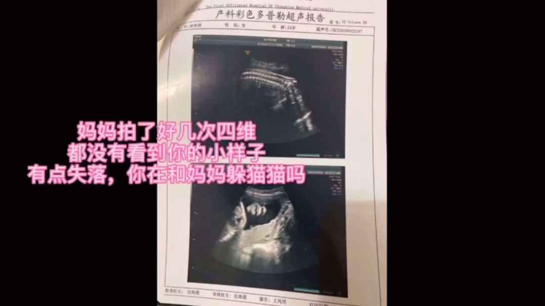11.26日 我的成长视频 中C班王晨帆
