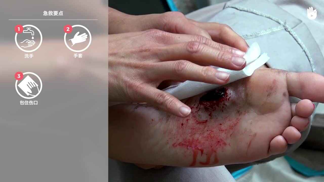 生存训练：出现严重伤口我们应该怎么办？