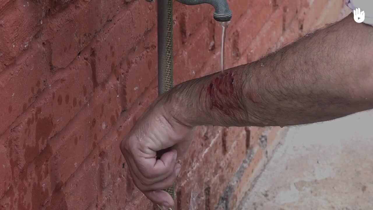 生存训练：动物或人类咬伤，怎么办？