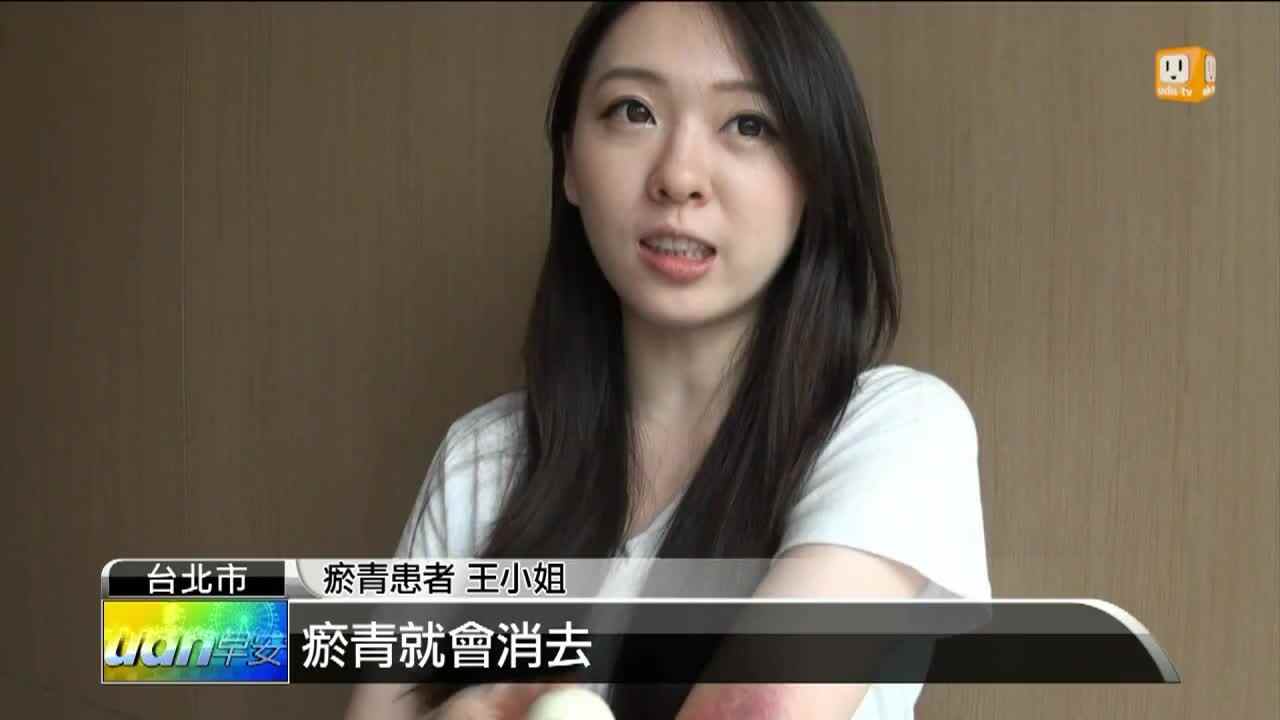 生存训练：水煮蛋除瘀青？